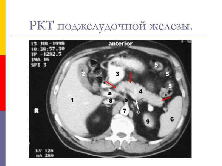 РКТ поджелудочной железы. 