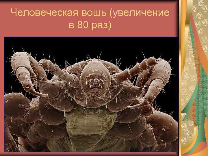 Человеческая вошь (увеличение в 80 раз) 