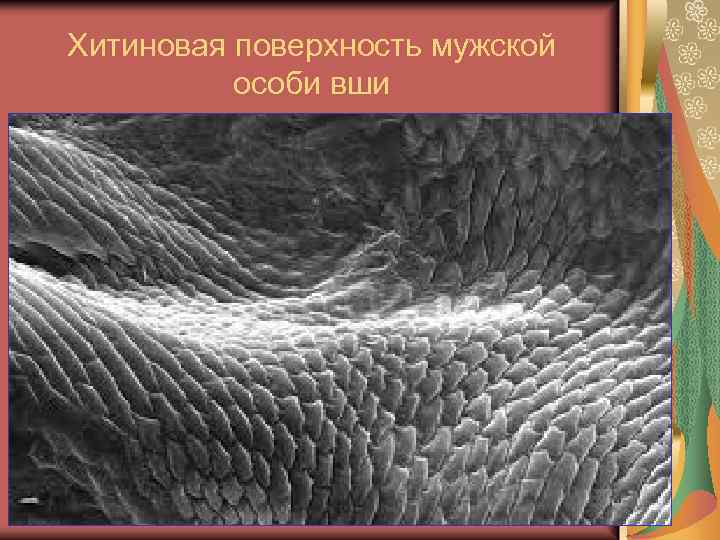 Хитиновая поверхность мужской особи вши 