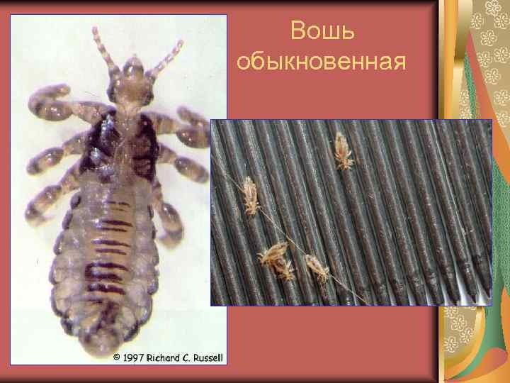 Вошь обыкновенная 