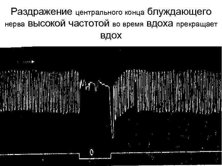 Раздражение центрального конца блуждающего нерва высокой частотой во время вдоха прекращает вдох 