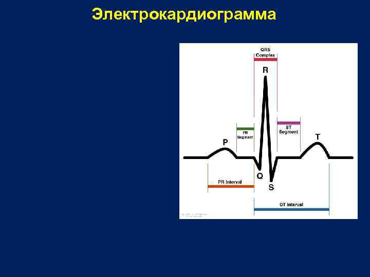 Электрокардиограмма 
