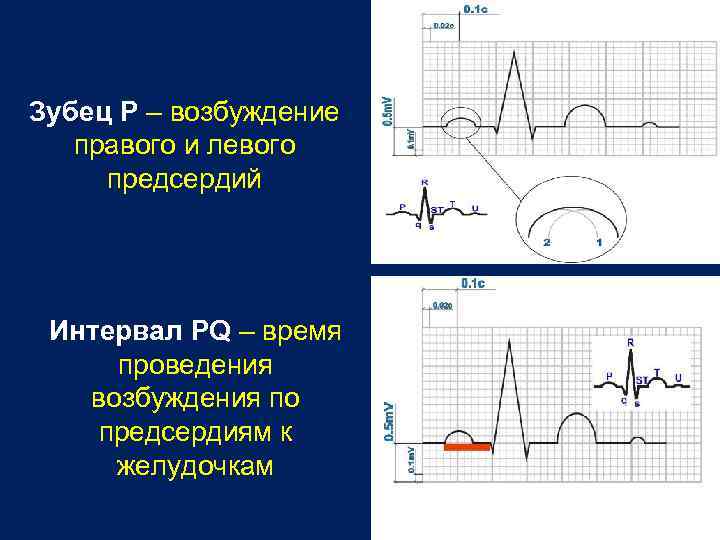 Зубец P – возбуждение правого и левого предсердий Интервал PQ – время проведения возбуждения
