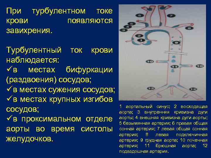 При турбулентном токе крови появляются завихрения. Турбулентный ток крови наблюдается: üв местах бифуркации (раздвоения)