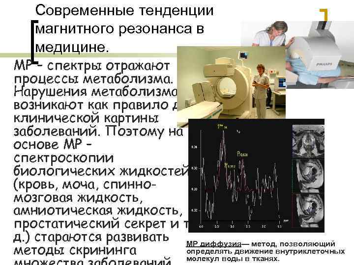 Современные тенденции магнитного резонанса в медицине. МР – спектры отражают процессы метаболизма. Нарушения метаболизма