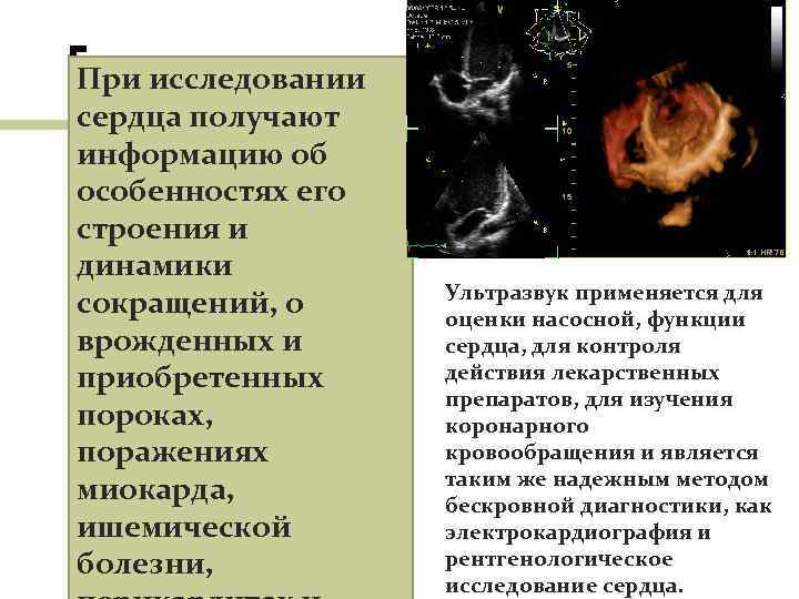 При исследовании сердца получают информацию об особенностях его строения и динамики сокращений, о врожденных