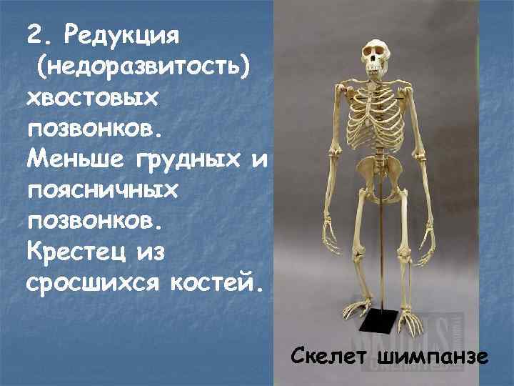 2. Редукция (недоразвитость) хвостовых позвонков. Меньше грудных и поясничных позвонков. Крестец из сросшихся костей.