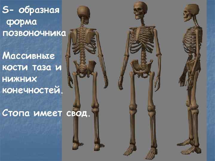 S- образная форма позвоночника Массивные кости таза и нижних конечностей. Стопа имеет свод. 