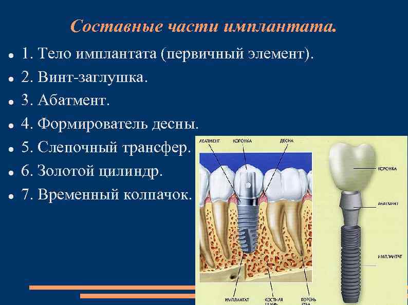 Составные части имплантата. 1. Тело имплантата (первичный элемент). 2. Винт-заглушка. 3. Абатмент. 4. Формирователь