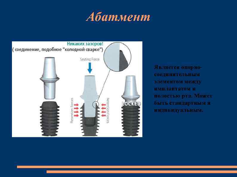 Абатмент Является опорносоединительным элементом между имплантатом и полостью рта. Может быть стандартным и индивидуальным.