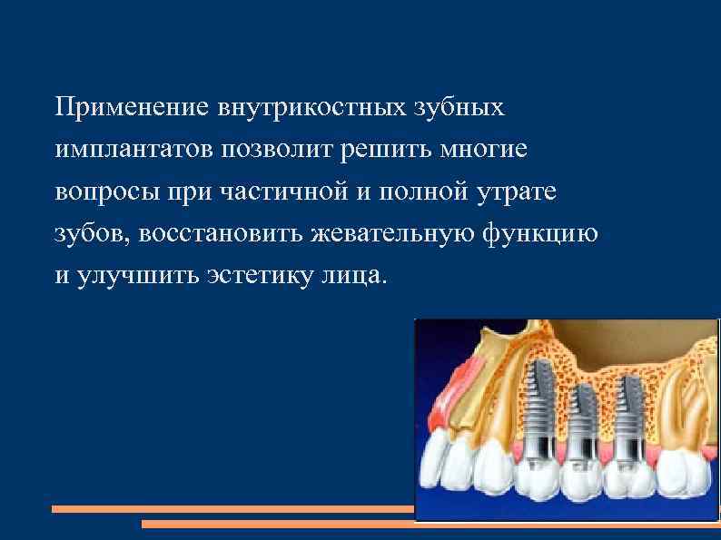 Применение внутрикостных зубных имплантатов позволит решить многие вопросы при частичной и полной утрате зубов,