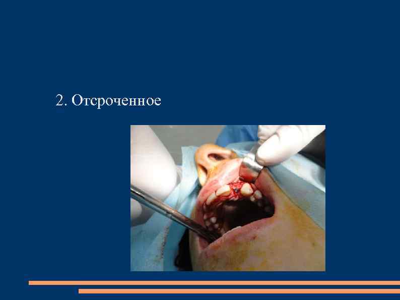 2. Отсроченное 