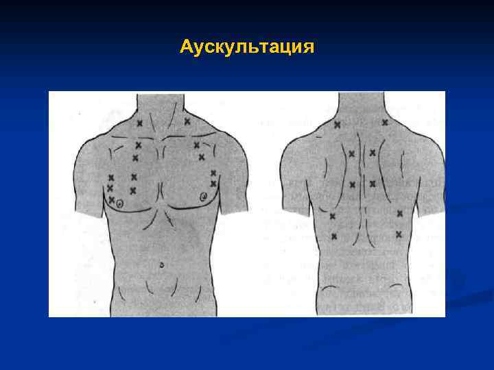 Точки аускультации легких картинки