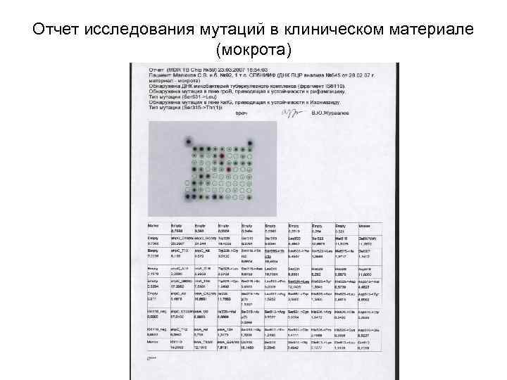 Отчет исследования мутаций в клиническом материале (мокрота) 