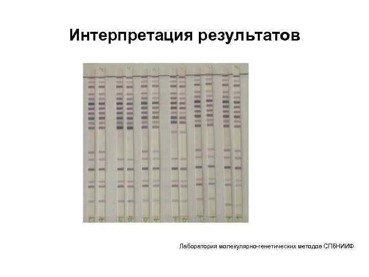 Интерпретация результатов Лаборатория молекулярно-генетических методов СПб. НИИФ 