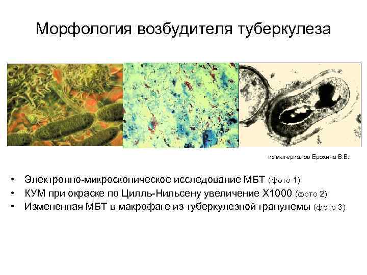 Морфология возбудителя туберкулеза из материалов Ерохина В. В. • Электронно-микроскопическое исследование МБТ (фото 1)