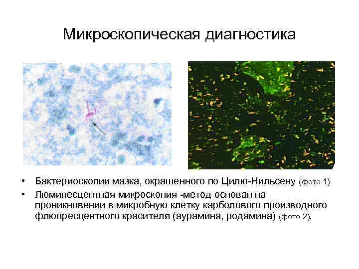 Перечислить методы микроскопии