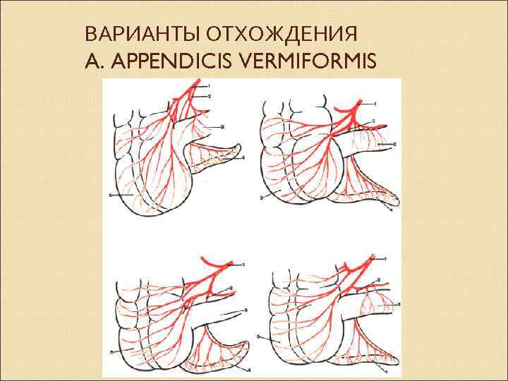 ВАРИАНТЫ ОТХОЖДЕНИЯ A. APPENDICIS VERMIFORMIS 