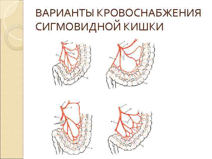 ВАРИАНТЫ КРОВОСНАБЖЕНИЯ СИГМОВИДНОЙ КИШКИ 