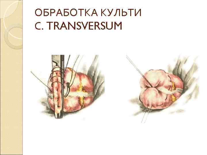 ОБРАБОТКА КУЛЬТИ С. TRANSVERSUM 