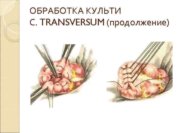 ОБРАБОТКА КУЛЬТИ С. TRANSVERSUM (продолжение) 