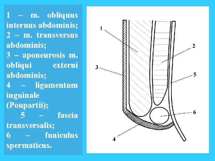 1 – m. obliquus internus abdominis; 2 – m. transversus abdominis; 3 – aponeurosis