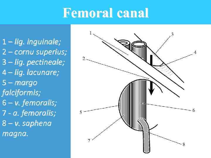 Femoral canal 1 – lig. inguinale; 2 – cornu superius; 3 – lig. pectineale;