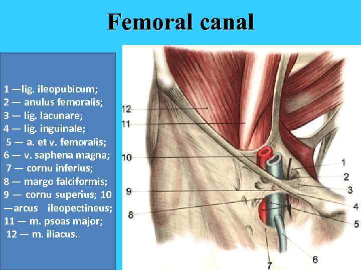 Femoral canal 1 —lig. ileopubicum; 2 — anulus femoralis; 3 — lig. lacunare; 4