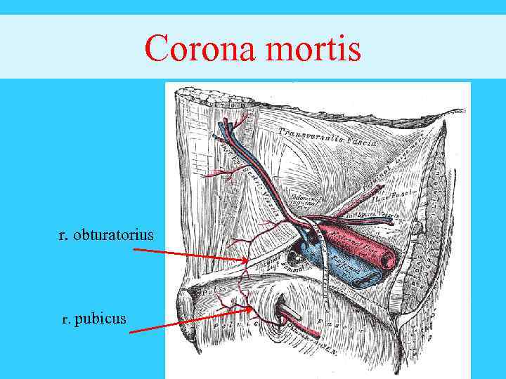 Corona mortis r. obturatorius r. pubicus 