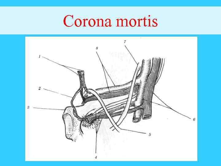 Corona mortis 