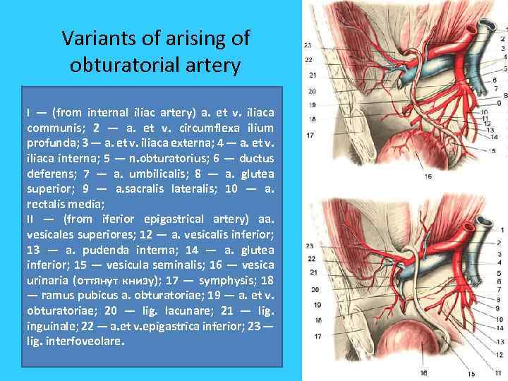 Variants of arising of obturatorial artery I — (from internal iliac artery) a. et