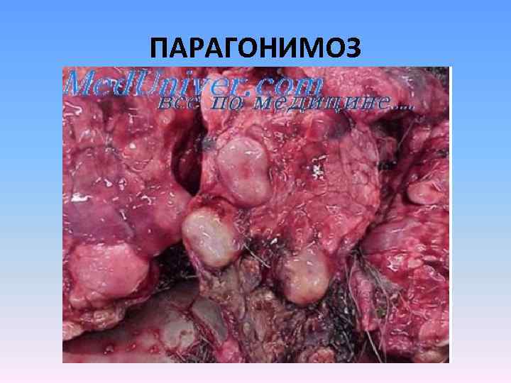 ПАРАГОНИМОЗ 