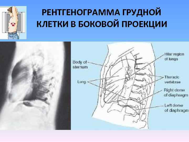 Схема описания рентгенограммы грудной клетки