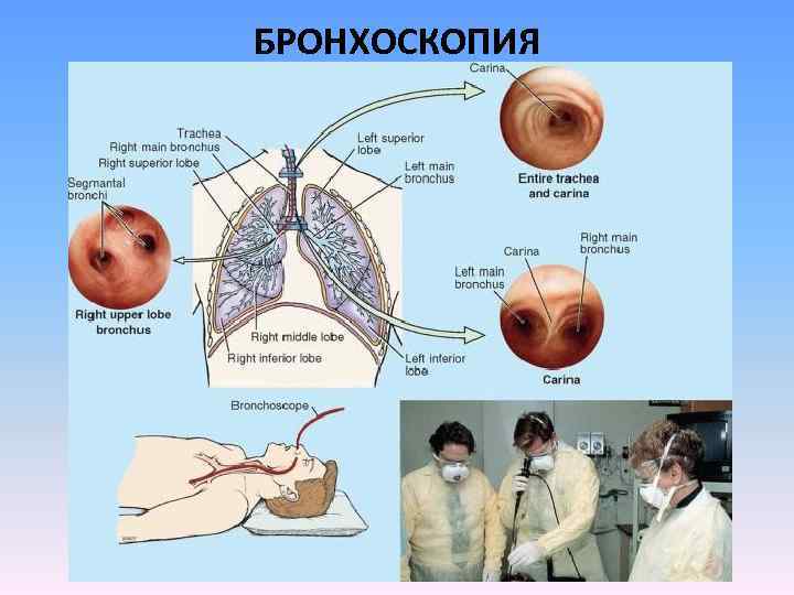 Эндоскопическая картина гпод