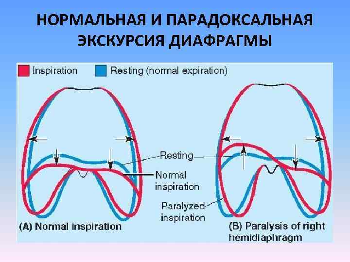 Диафрагма фото анатомия