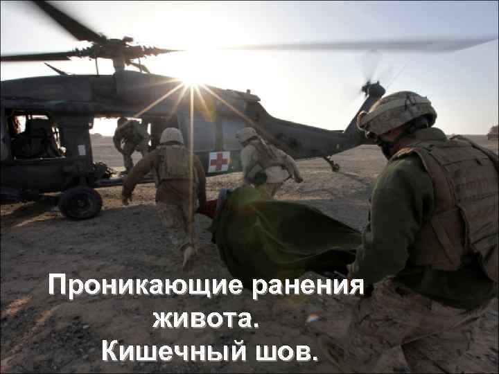 Проникающие ранения живота. Кишечный шов. 