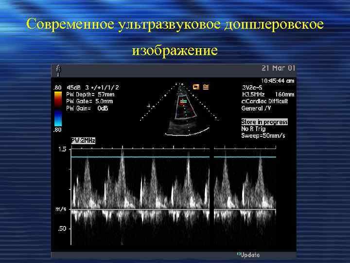 Современное ультразвуковое допплеровское изображение 