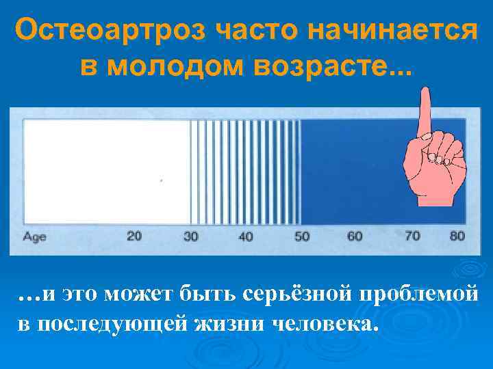 Остеоартроз часто начинается в молодом возрасте. . . …и это может быть серьёзной проблемой