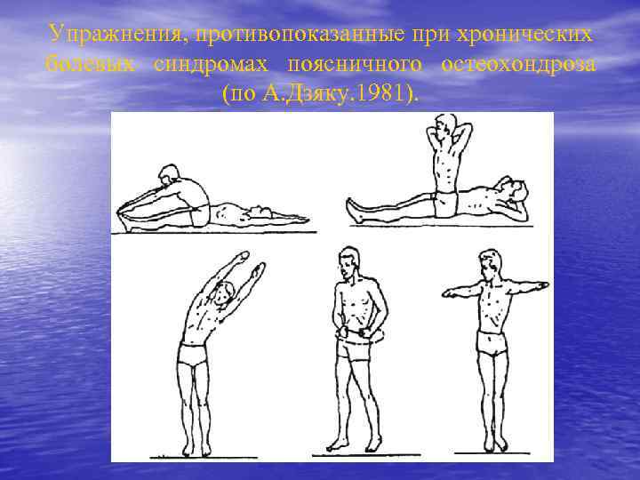Упражнения, противопоказанные при хронических болевых синдромах поясничного остеохондроза (по А. Дзяку. 1981). 