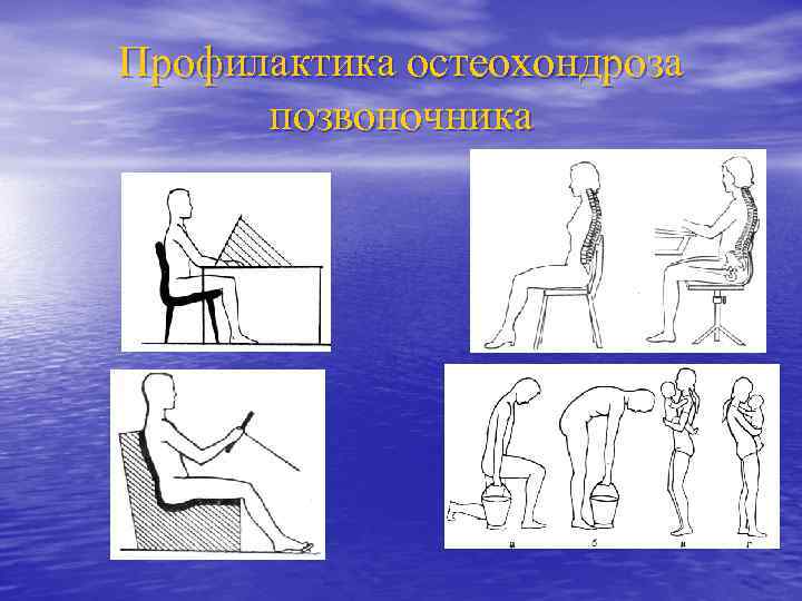 Профилактика остеохондроза позвоночника 