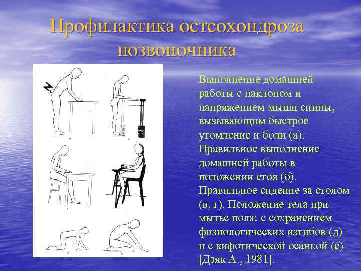 Профилактика остеохондроза позвоночника картинки