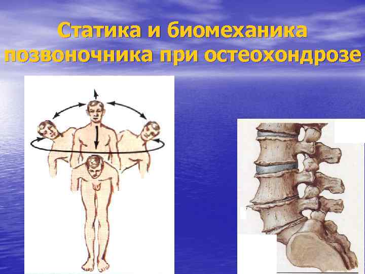 Статика и биомеханика позвоночника при остеохондрозе 