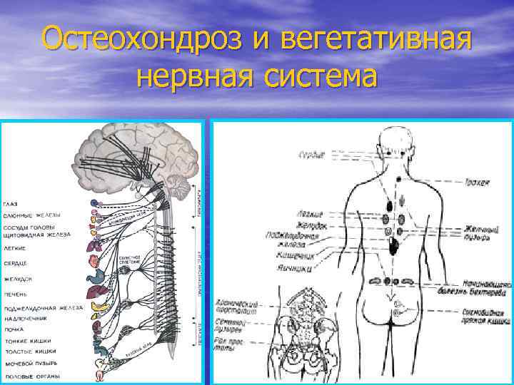 Остеохондроз и вегетативная нервная система 