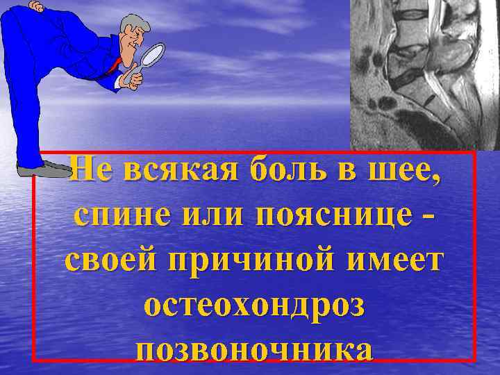 Не всякая боль в шее, спине или пояснице своей причиной имеет остеохондроз позвоночника 