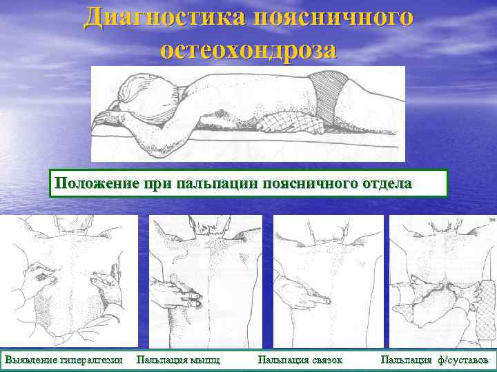 Диагностика поясничного остеохондроза Положение при пальпации поясничного отдела Выявление гипералгезии Пальпация мышц Пальпация связок