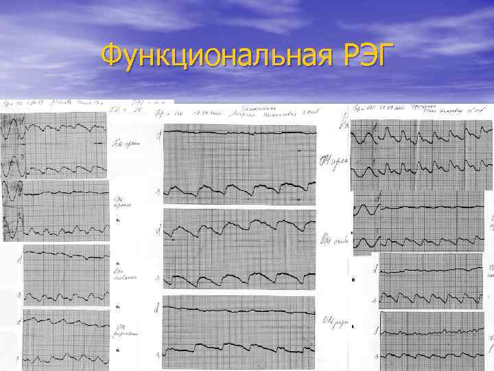 Функциональная РЭГ 