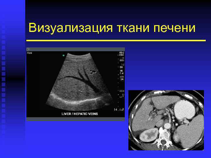Визуализация ткани печени 