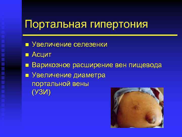 Портальная гипертония n n Увеличение селезенки Асцит Варикозное расширение вен пищевода Увеличение диаметра портальной