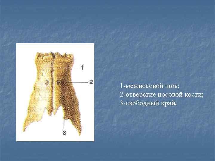 1 -межносовой шов; 2 -отверстие носовой кости; 3 -свободный край. 