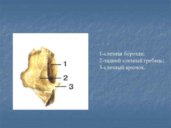 1 -слезная борозда; 2 -задний слезный гребень; 3 -слезный крючок. 